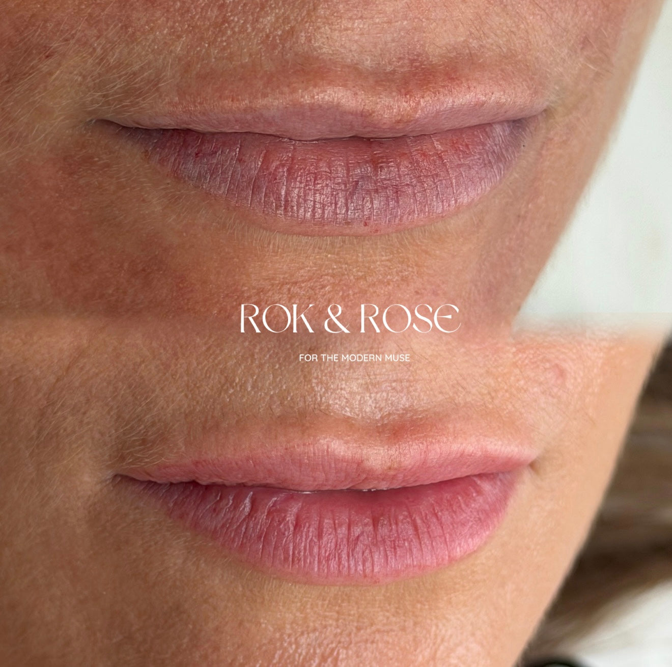 Close-up of a person's lips showing a before-and-after comparison of dry, cracked lips to a hydrated, smooth, and glossy lip look. The text 'ROK & ROSE FOR THE MODERN FACE' is overlaid in the center.