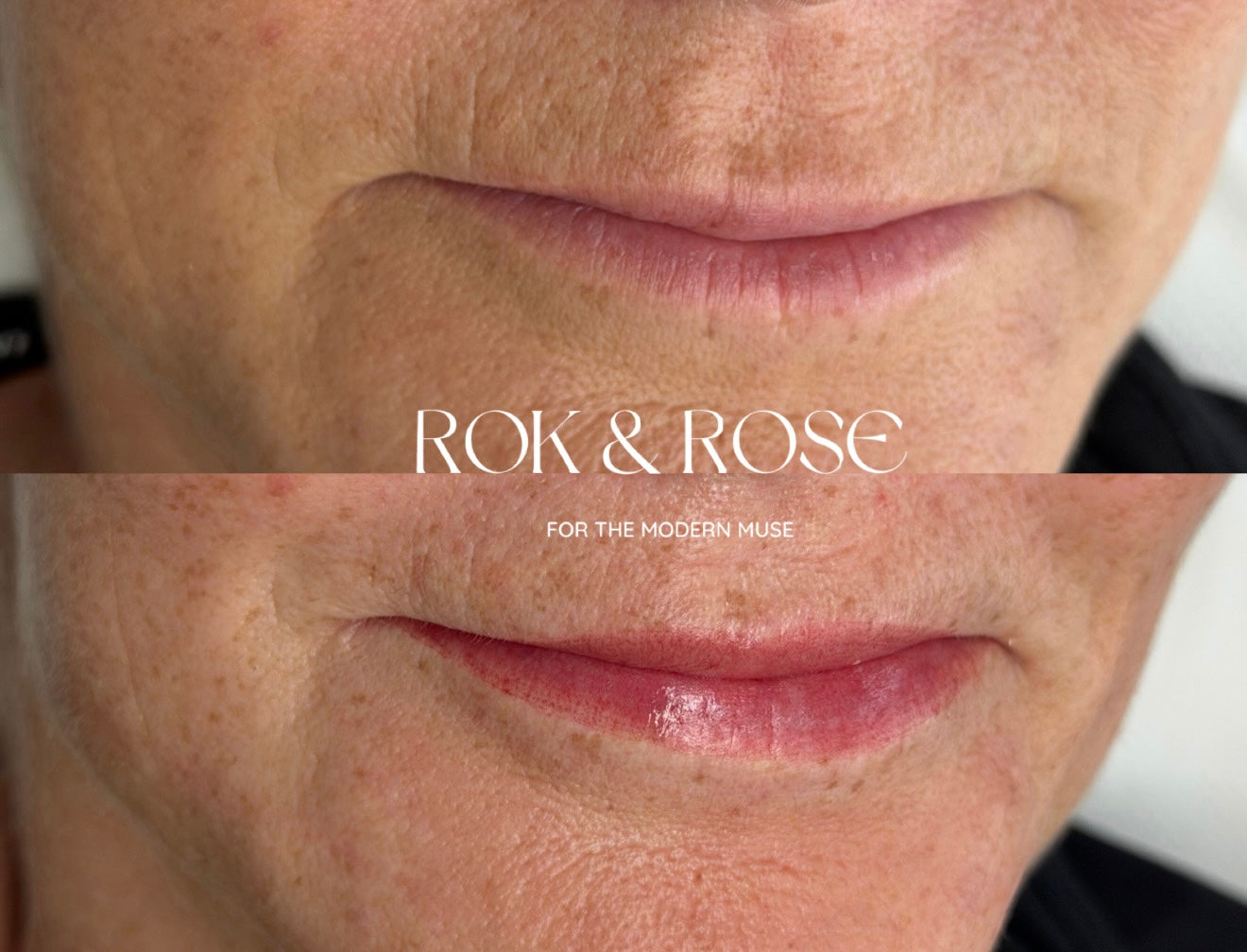 Close-up before-and-after style comparison of a person's lower face, focusing on the mouth and cheek area, with visible skin texture and freckles. White text across the center reads 'ROK & ROSE' and smaller text below reads 'FOR THE MODERN MUSE'.