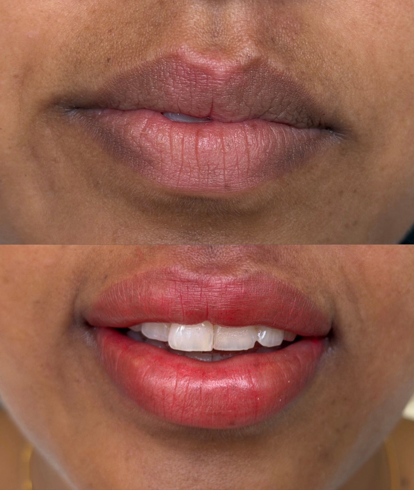 A close-up before-and-after style comparison of a person's lips. The top panel shows lips with a muted rosy pink tone, and the bottom panel shows the same lips with a brighter rosy red tone and white teeth visible.