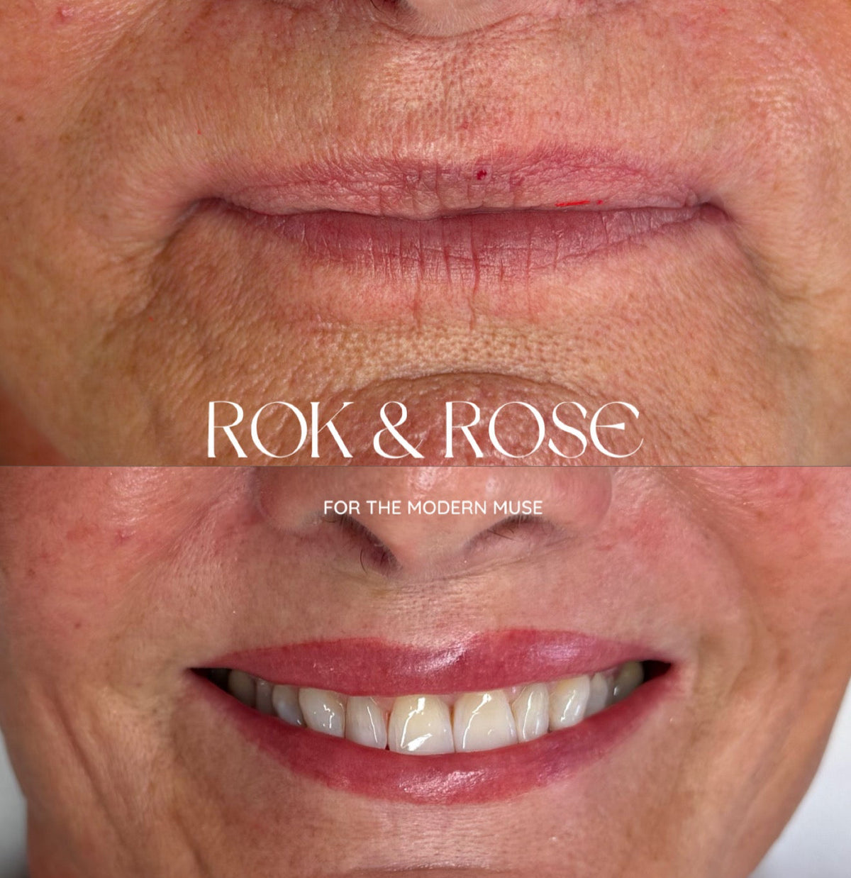 Before-and-after close-up comparison of a woman's lower face, showing wrinkles and skin texture in the top panel and smoother, more youthful skin in the bottom panel. The text 'ROK & ROSE' is overlaid across the center. Before and after lip blush fro 50+ mature woman