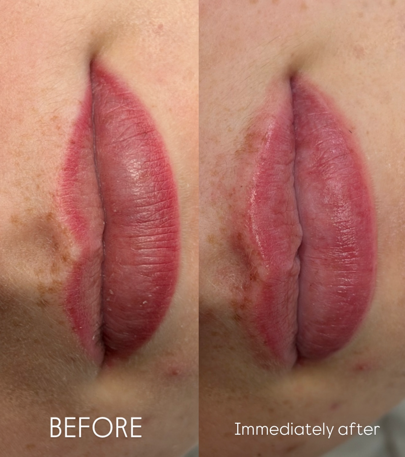 Close-up before-and-after comparison of lips showing a lip treatment or cosmetic result. The left side is labeled 'BEFORE' and shows slightly uneven, less saturated lips.