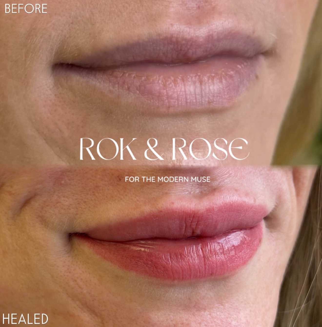Before and after close-up of a person's lips showing lip makeup results, with the text 'BEFORE', 'ROK & ROSE FOR THE MODERN MUSE', and 'HEALED'.